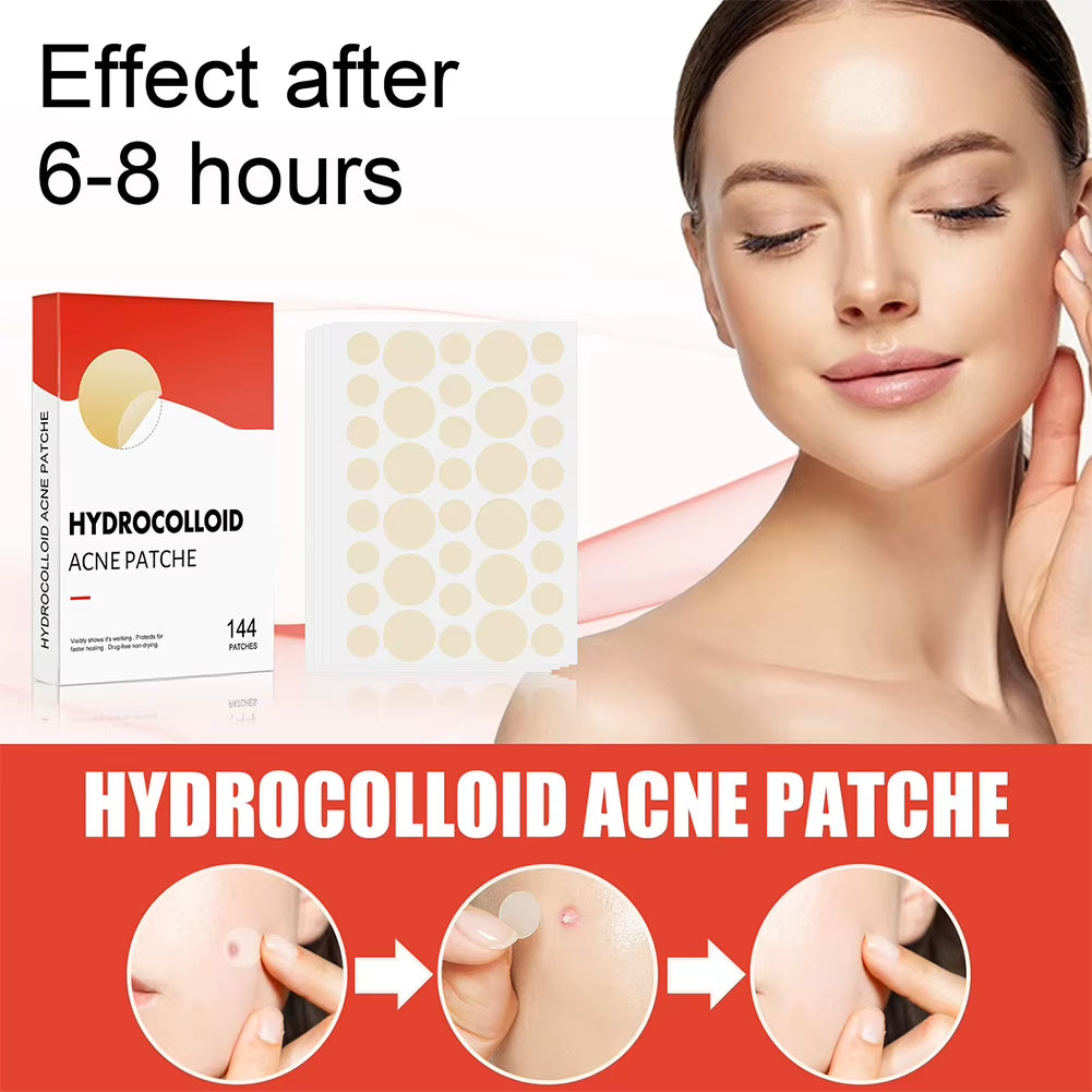 144Pcs/Set Acne Pimple Patch 