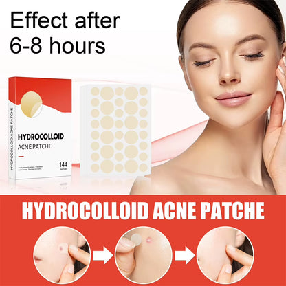 144Pcs/Set Acne Pimple Patch 
