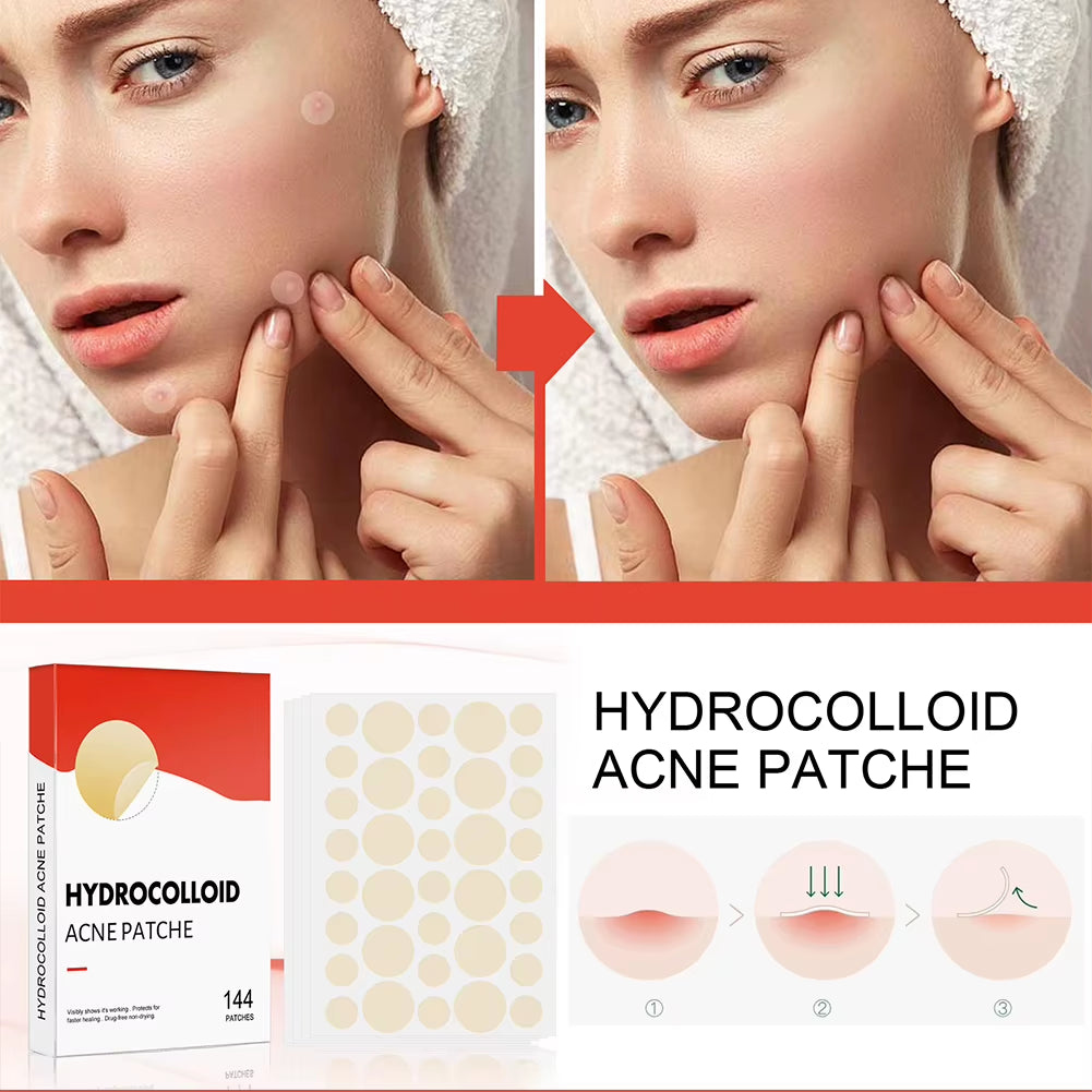 144Pcs/Set Acne Pimple Patch 