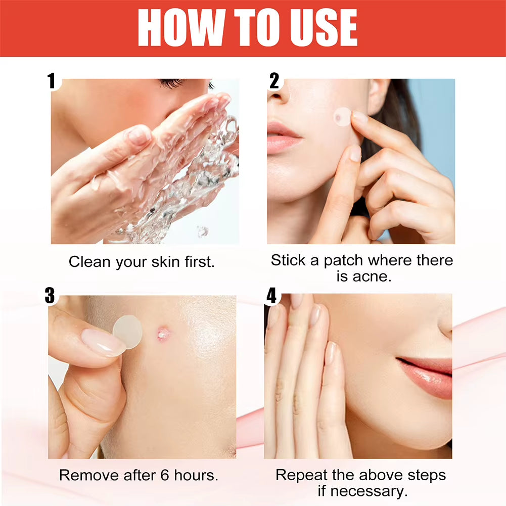 144Pcs/Set Acne Pimple Patch 