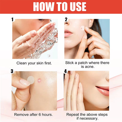 144Pcs/Set Acne Pimple Patch 
